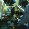 Preliminary surgical steps being completed for a small Liberian girl